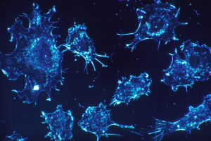 How Pain Fuels Cancer Growth